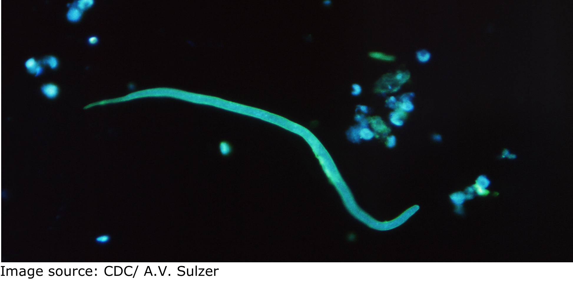 A micrograph showing a long, greenish-blue worm in a dark field/background