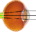 farsighted eyeball